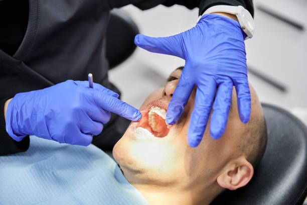 Best Chipped Tooth Repair Near Me  in Greenville, NY